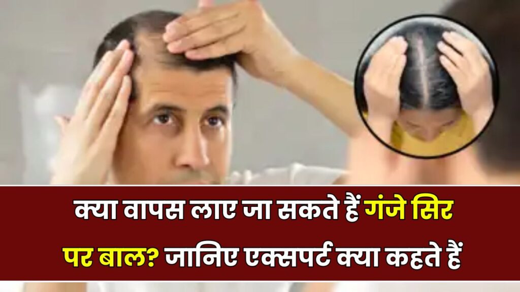 गंजे सिर पर दोबारा बाल लाना मुमकिन है? जानिए एक्सपर्ट क्या कहते हैं